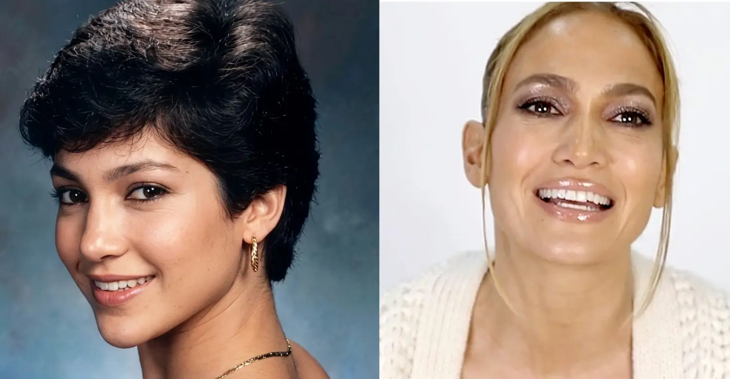 Jennifer Lopez teeth